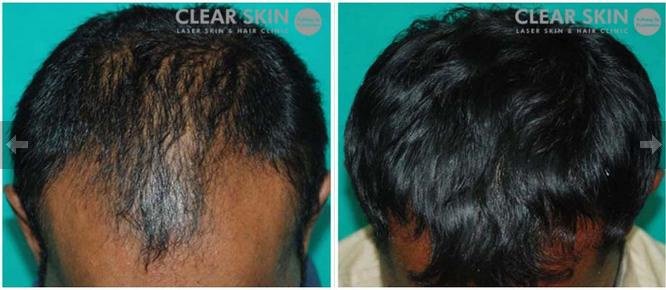 Clear Skin Clinic
